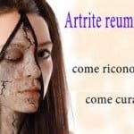 A Milano corso sulla riabilitazione nelle persone affette da artrite reumatoide