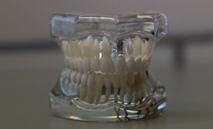 Protesi dentali: la tua ce l’ha il “passaporto”? I consigli di AIOP per tutelarsi da quelle fasulle