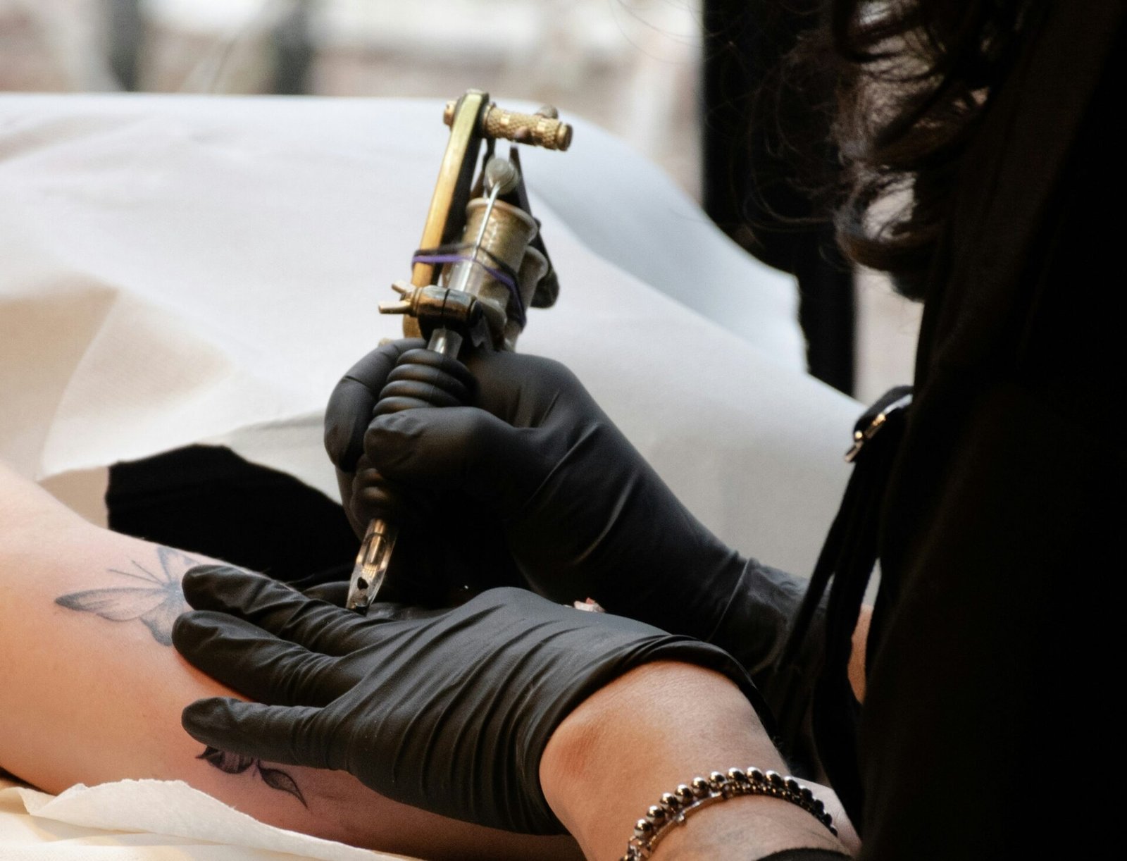 Rimozione dei tatuaggi: innovazione e sicurezza