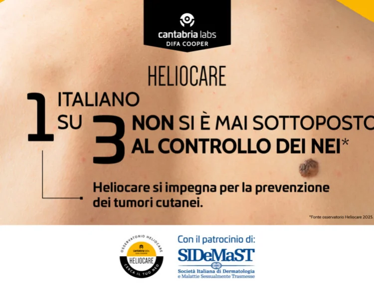 Cerca il tuo neo 2026